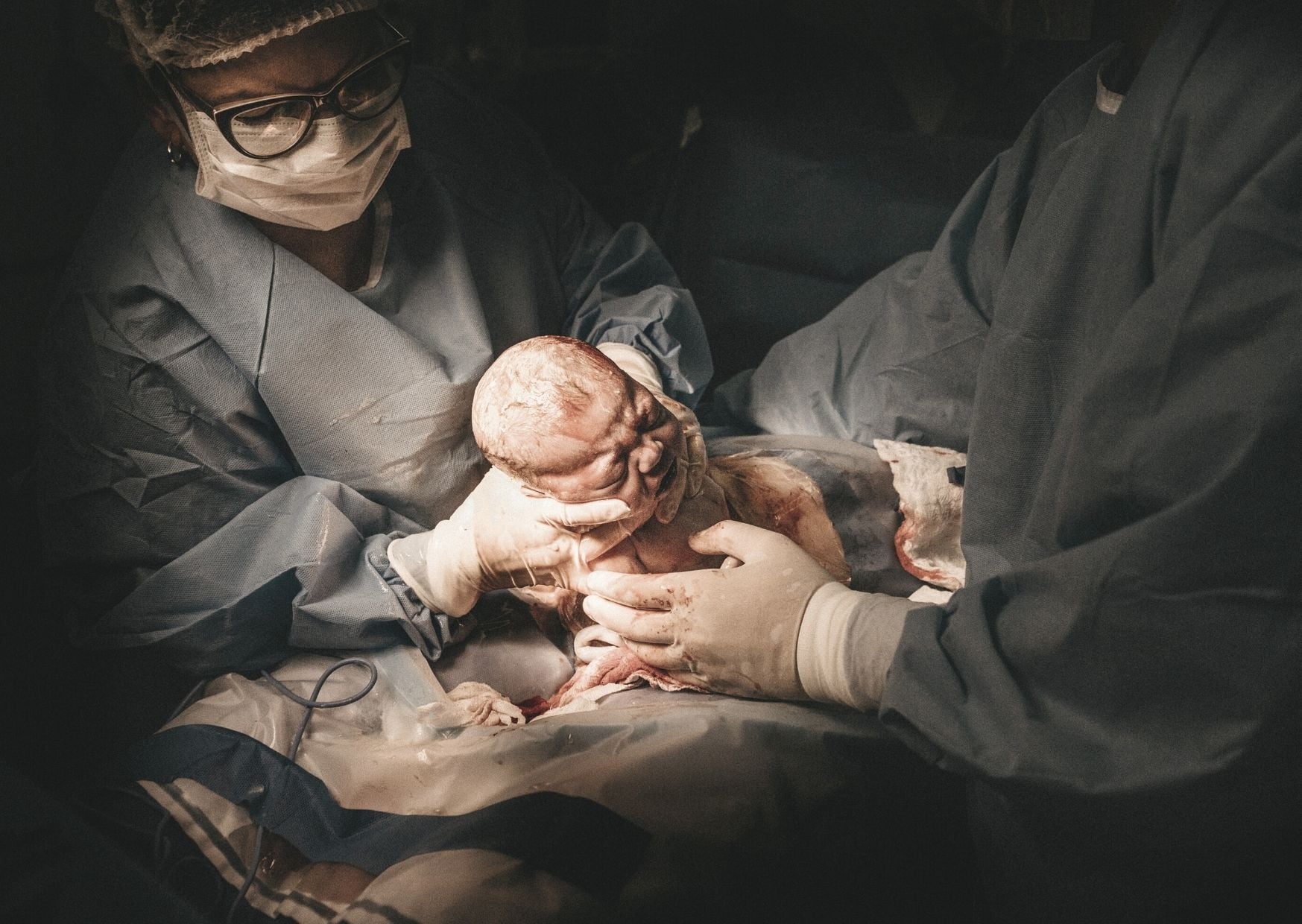 Baby bei Kaiserschnittgeburt Baby bei Kaiserschnittgeburt