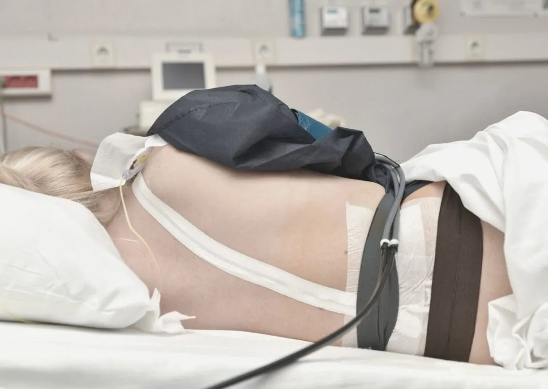 CTG bei geburt CTG bei der Geburt