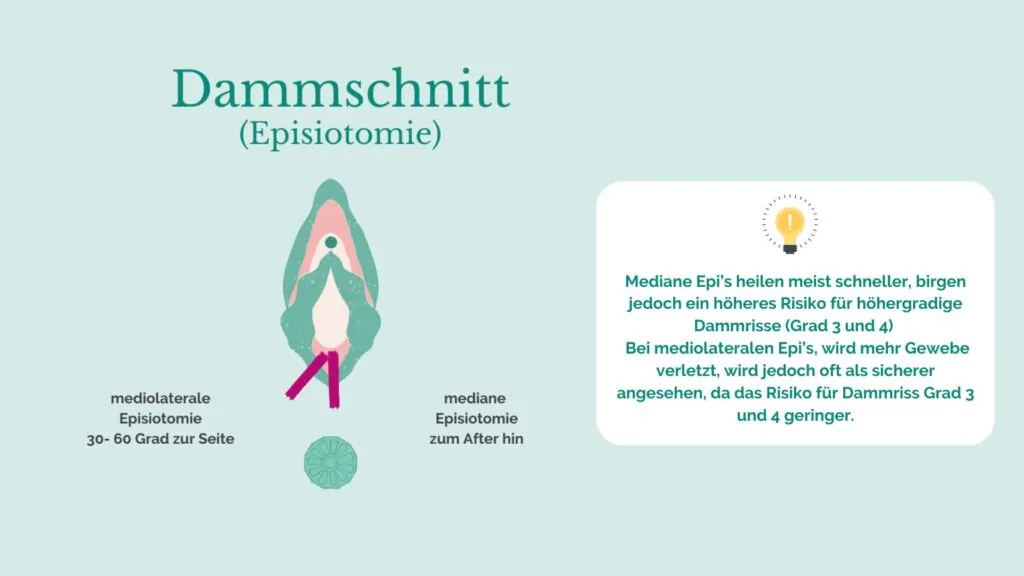 Dammschnitt Dammschnitt