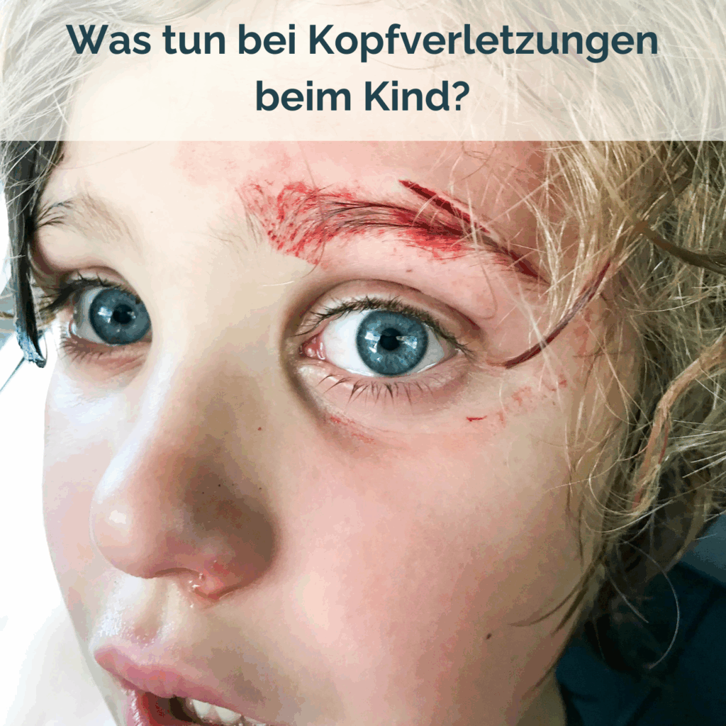 Kostenloser Download Kopfverletzungen bei Kindern