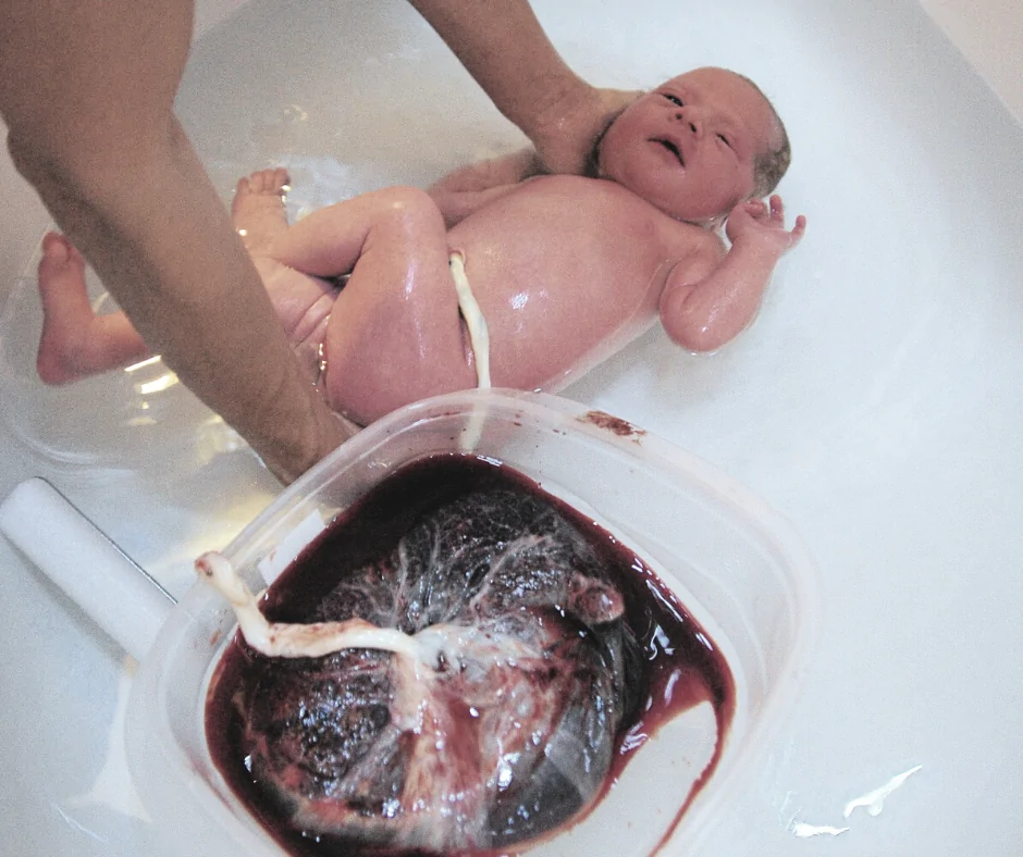 Lotusgeburt Baby nach einer Lotusgeburt mit Nabelschnur