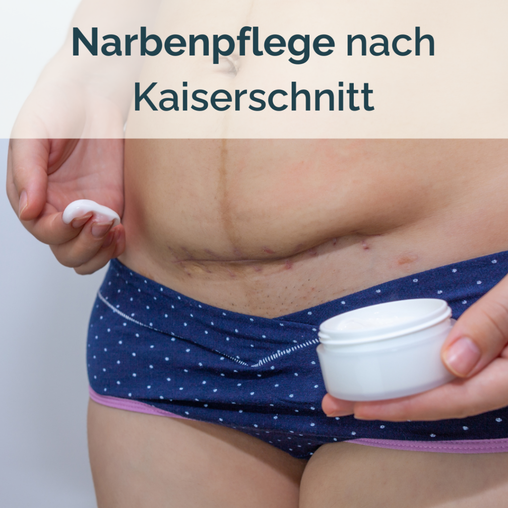 Narbenpflege Kaiserschnitt Kurs