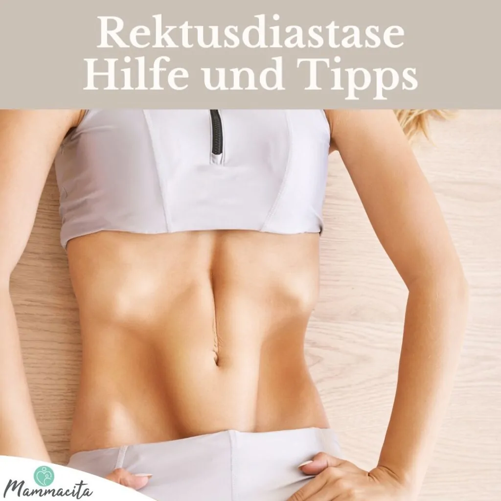 Rectusdiastase Betragsbild