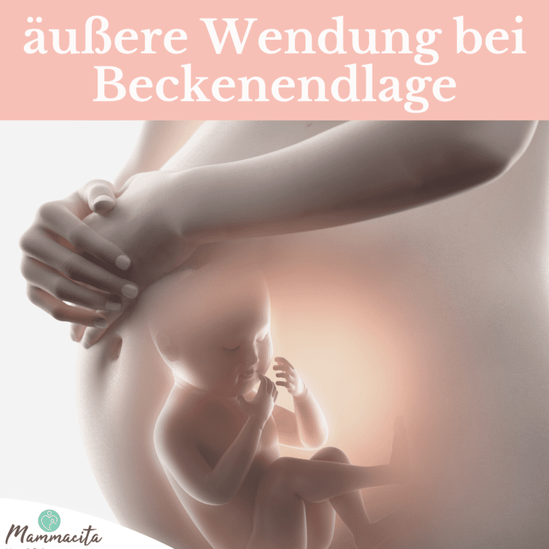 Äußere Wendung bei Beckenendlage