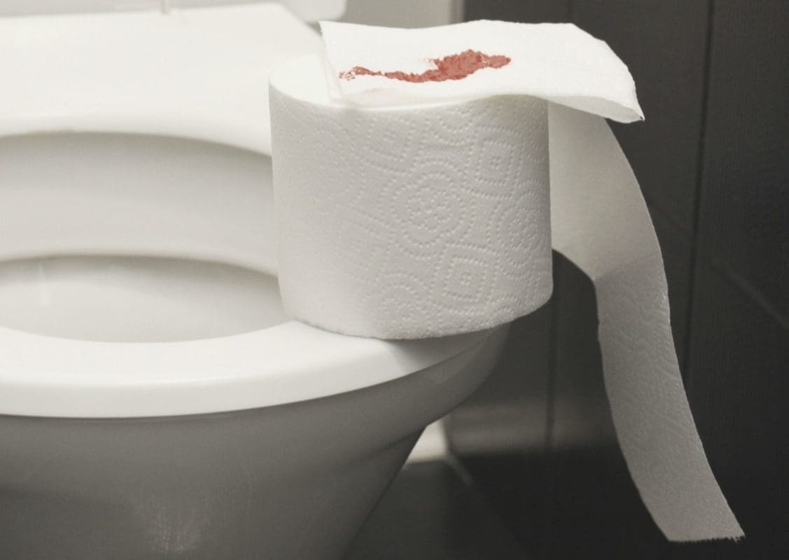 blutiges Toilettenpapier Sympthome bei Hämorrhoiden in der Schwangerschaft