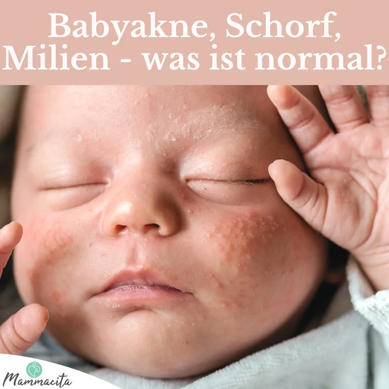 Beitragsbild Babyhaut Beitragsbild Babyhaut
