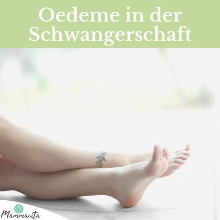 Beitragsbild-Wassereinlagerungen-Schwangerschaft Beitragsbild-Wassereinlagerungen-Schwangerschaft