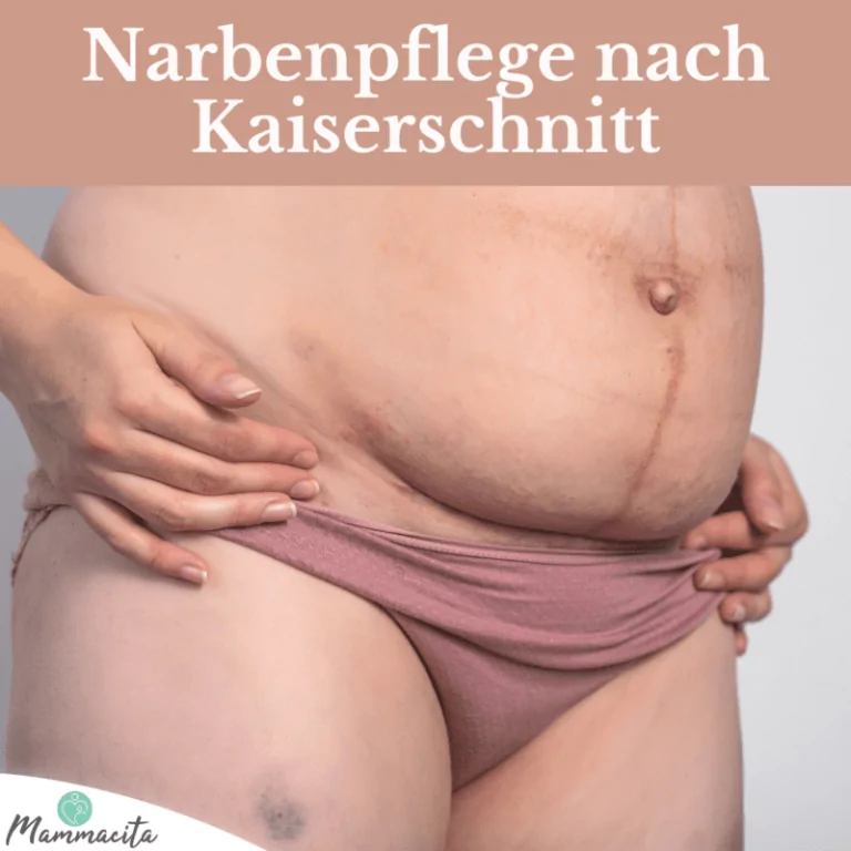 Narbenpflege-Kaiserschnitt-Beitragsbild Narbenpflege: Der richtige Umgang mit der Kaiserschnittnarbe
