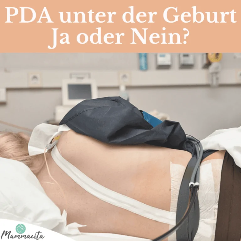 PDA-unter-Geburt-Beitragsbild PDA-unter-Geburt-Beitragsbild