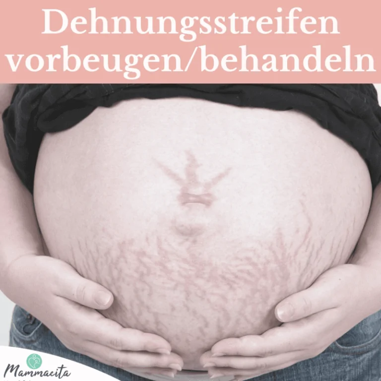 schwangerschaftsstreifen-beitragsbild Schwangerschaftsstreifen - was hilft wirklich?