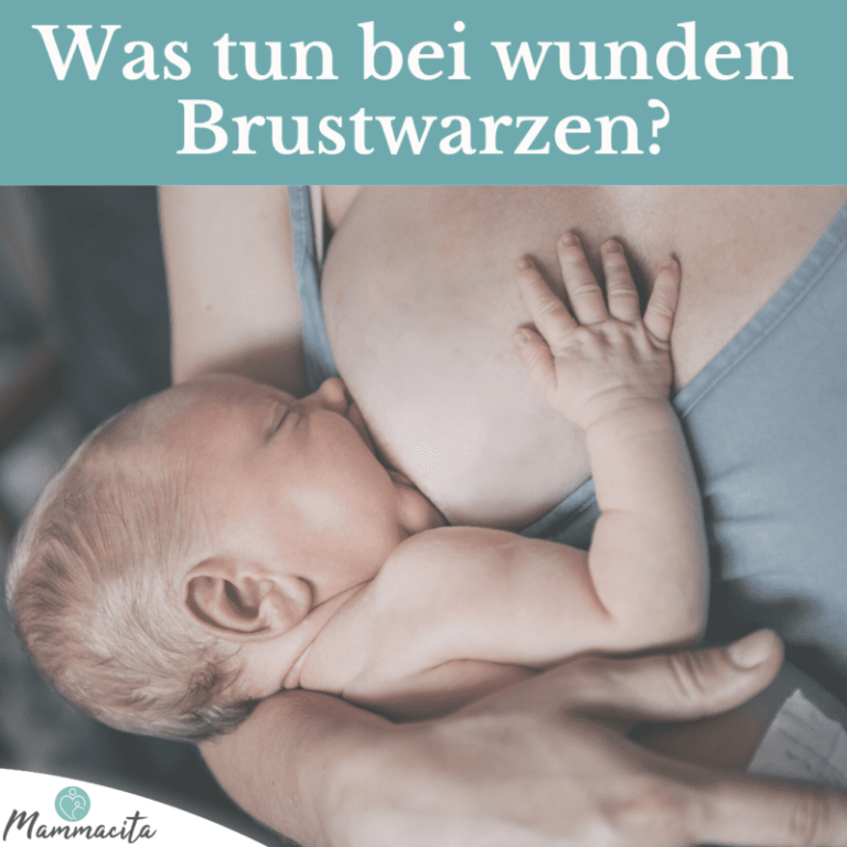 wunde-Brustwarzen-Beitragsbild Wunde Brustwarzen – Hausmittel, Tipps & vorbeugende Maßnahmen