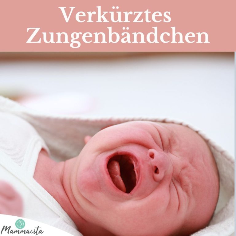Zungenbaendchen Zungenbändchen Beitragsbild
