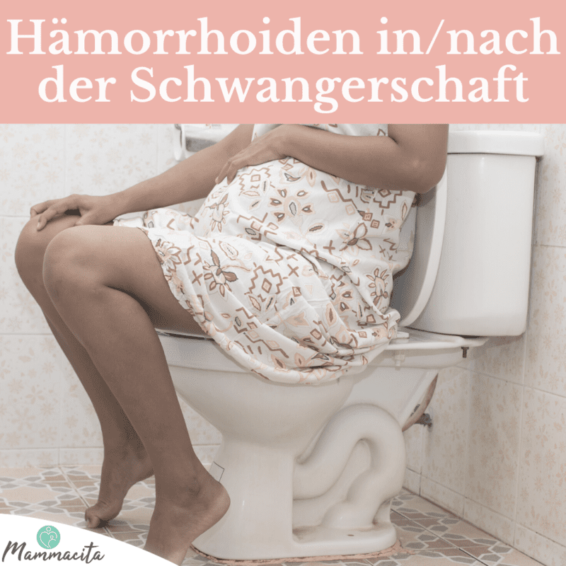 Hämorrhoiden in der Schwangerschaft - Vorbeugung und Therapie