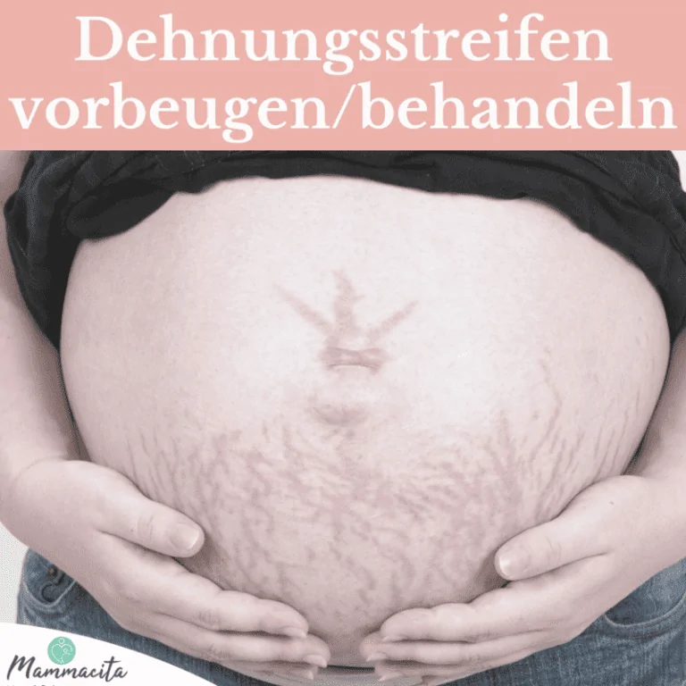 Schwangerschaftsstreifen - was hilft wirklich?