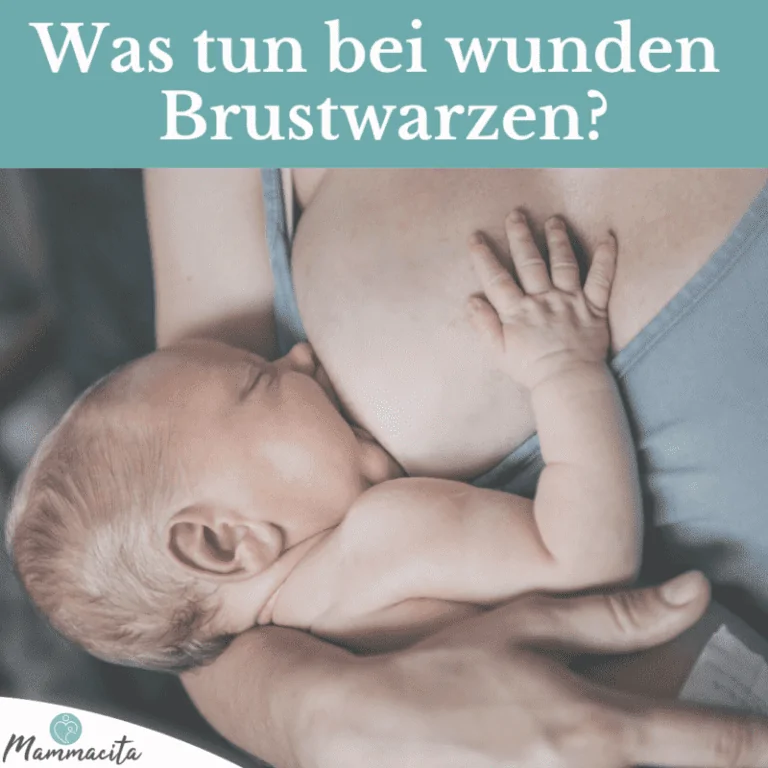 Wunde Brustwarzen – Hausmittel, Tipps & vorbeugende Maßnahmen