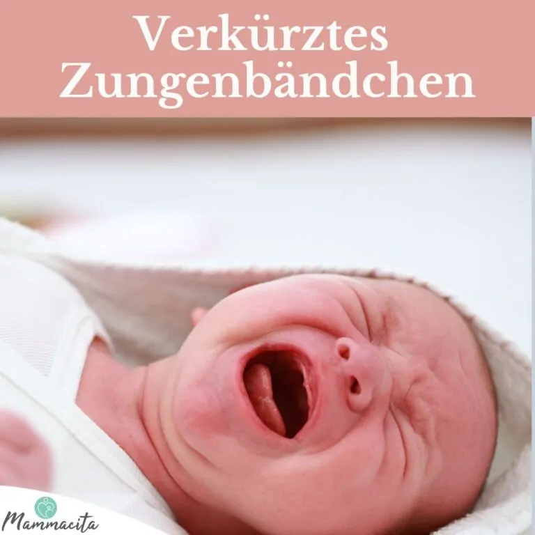 Zungenbändchen Beitragsbild